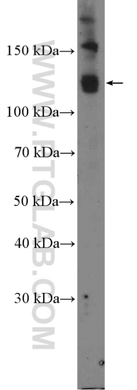 Western Blot (WB) analysis of Raji cells using RBL2 Polyclonal antibody (27251-1-AP)