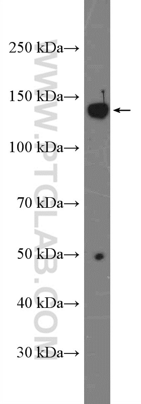 WB analysis of A549 using 27251-1-AP