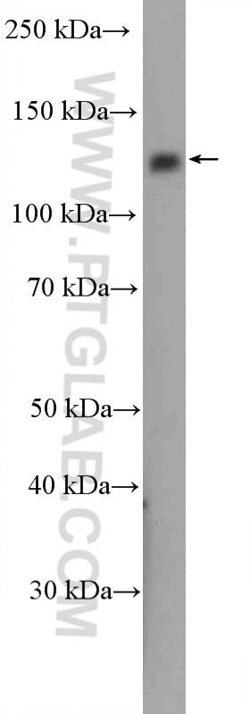 Western Blot (WB) analysis of A549 cells using RBL2 Polyclonal antibody (27251-1-AP)