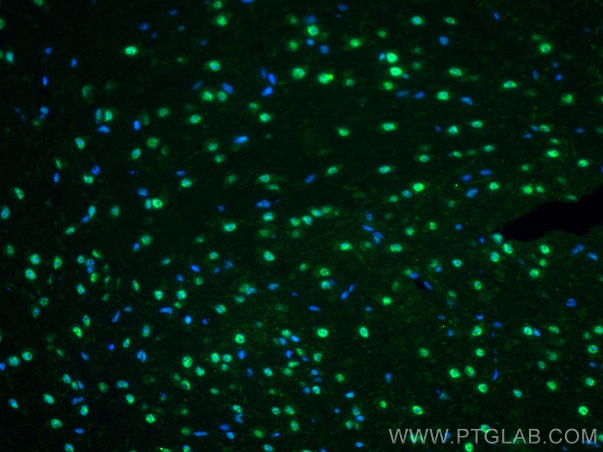 Immunofluorescence (IF) / fluorescent staining of mouse brain tissue using RBM10 Polyclonal antibody (14423-1-AP)