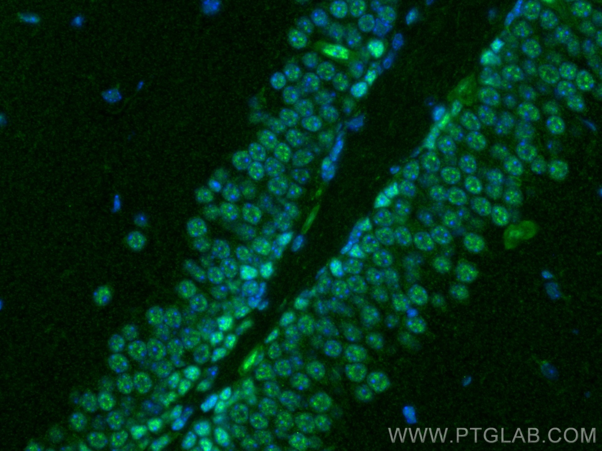 Immunofluorescence (IF) / fluorescent staining of mouse brain tissue using RBM10 Polyclonal antibody (14423-1-AP)