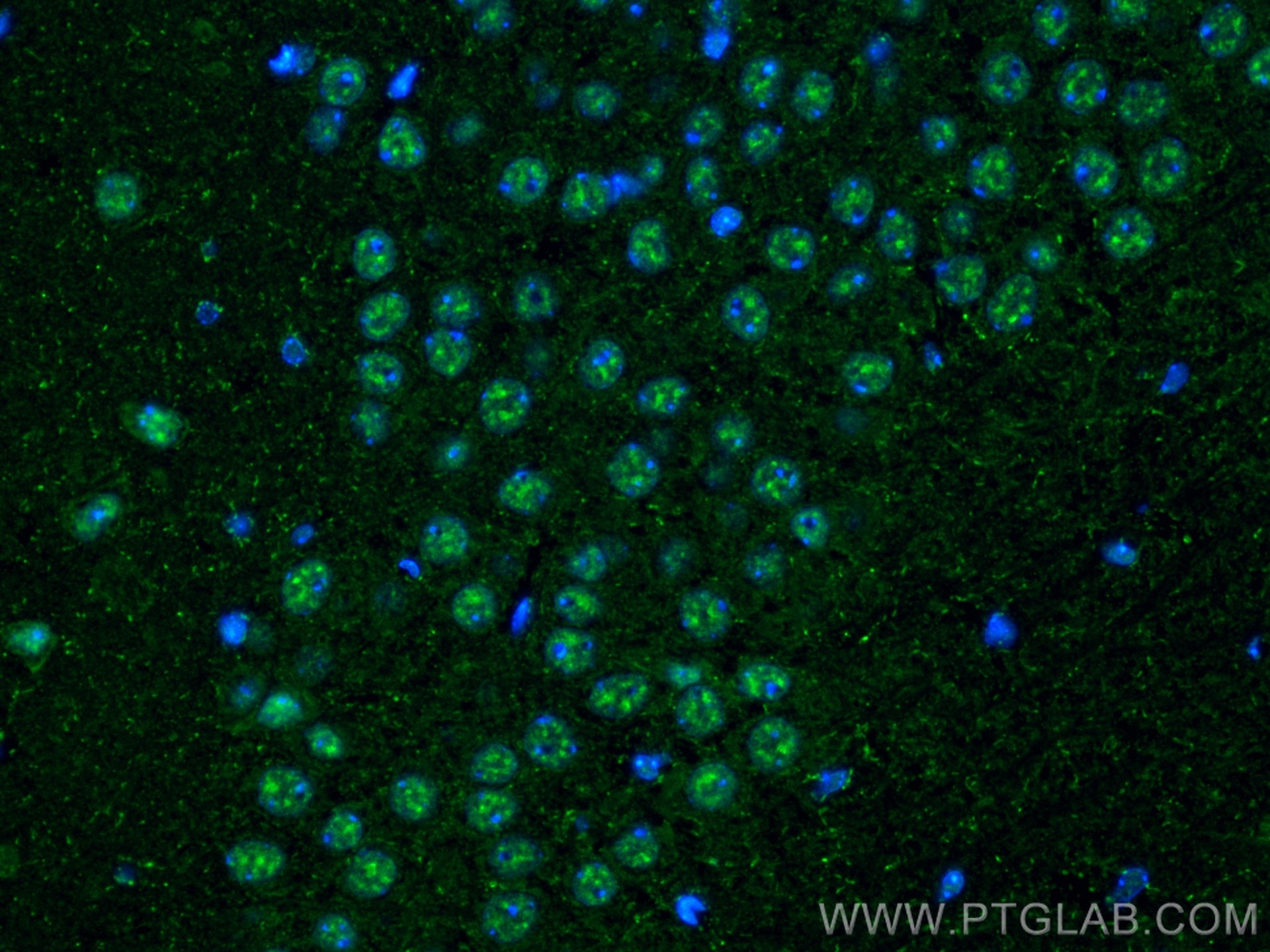 Immunofluorescence (IF) / fluorescent staining of mouse brain tissue using RBM10 Polyclonal antibody (14423-1-AP)