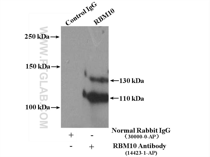 Immunoprecipitation (IP) experiment of mouse brain tissue using RBM10 Polyclonal antibody (14423-1-AP)