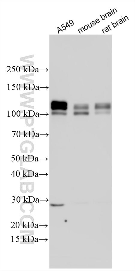 Western Blot (WB) analysis of various lysates using RBM10 Polyclonal antibody (14423-1-AP)