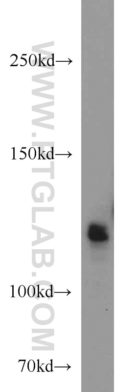 Western Blot (WB) analysis of human brain tissue using RBM10 Polyclonal antibody (14423-1-AP)