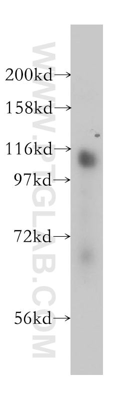 Western Blot (WB) analysis of human brain tissue using RBM10 Polyclonal antibody (14423-1-AP)