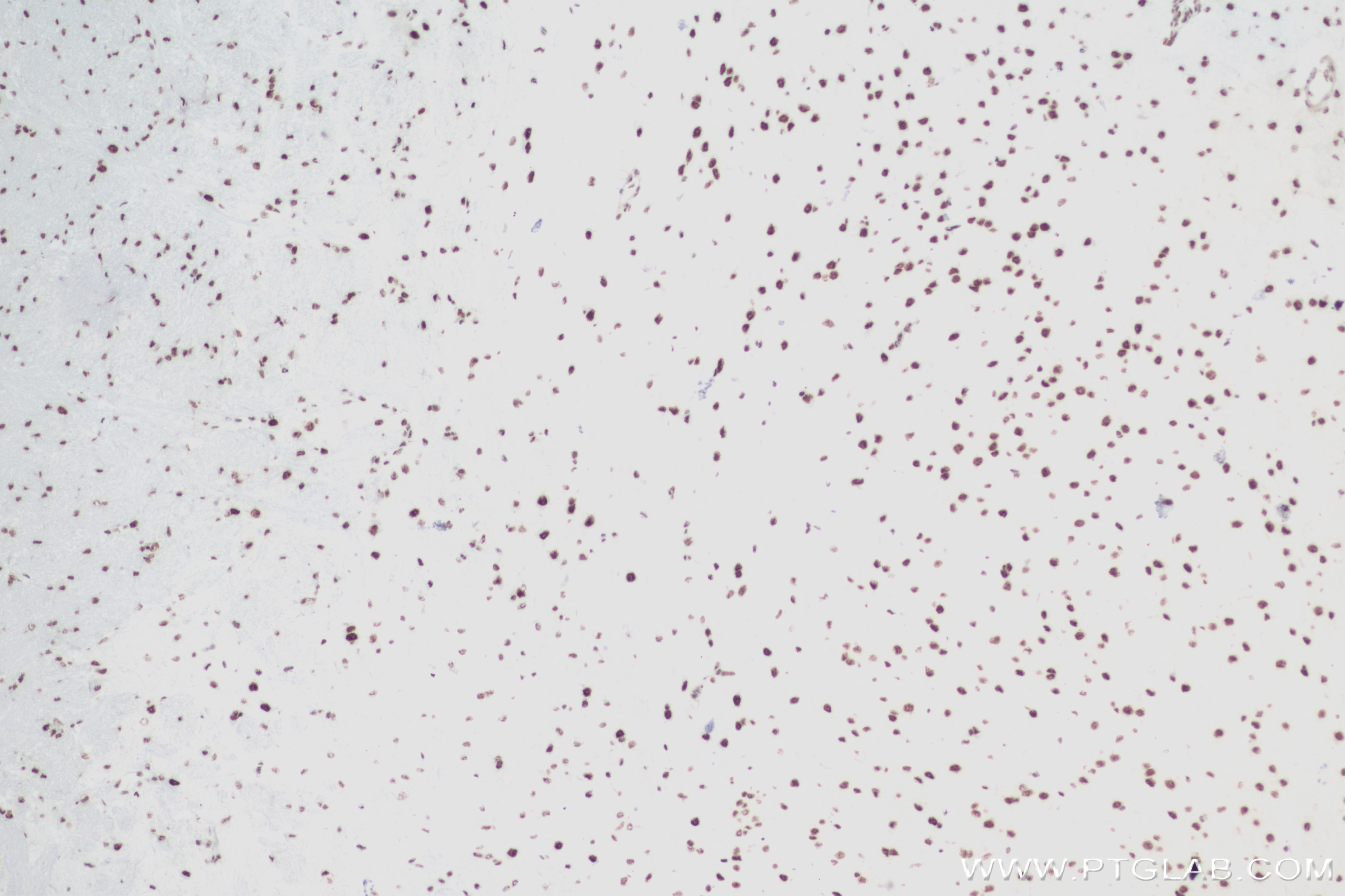Immunohistochemistry (IHC) staining of mouse brain tissue using RBM10 Recombinant antibody (84104-2-RR)