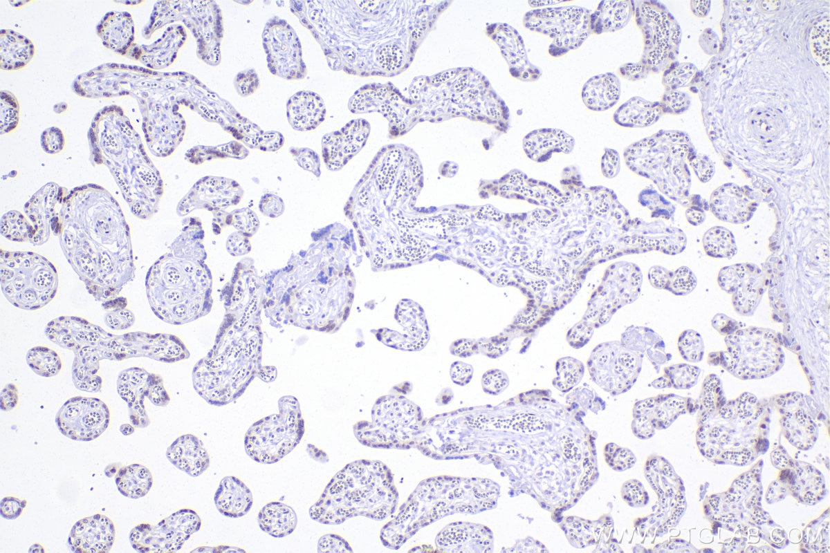 Immunohistochemistry (IHC) staining of human placenta tissue using RBM10 Recombinant monoclonal antibody (84104-2-RR)