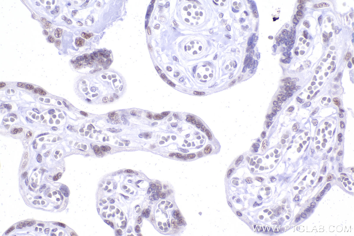 Immunohistochemistry (IHC) staining of human placenta tissue using RBM10 Recombinant monoclonal antibody (84104-2-RR)