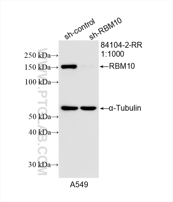 Western Blot (WB) analysis of A549 cells using RBM10 Recombinant antibody (84104-2-RR)