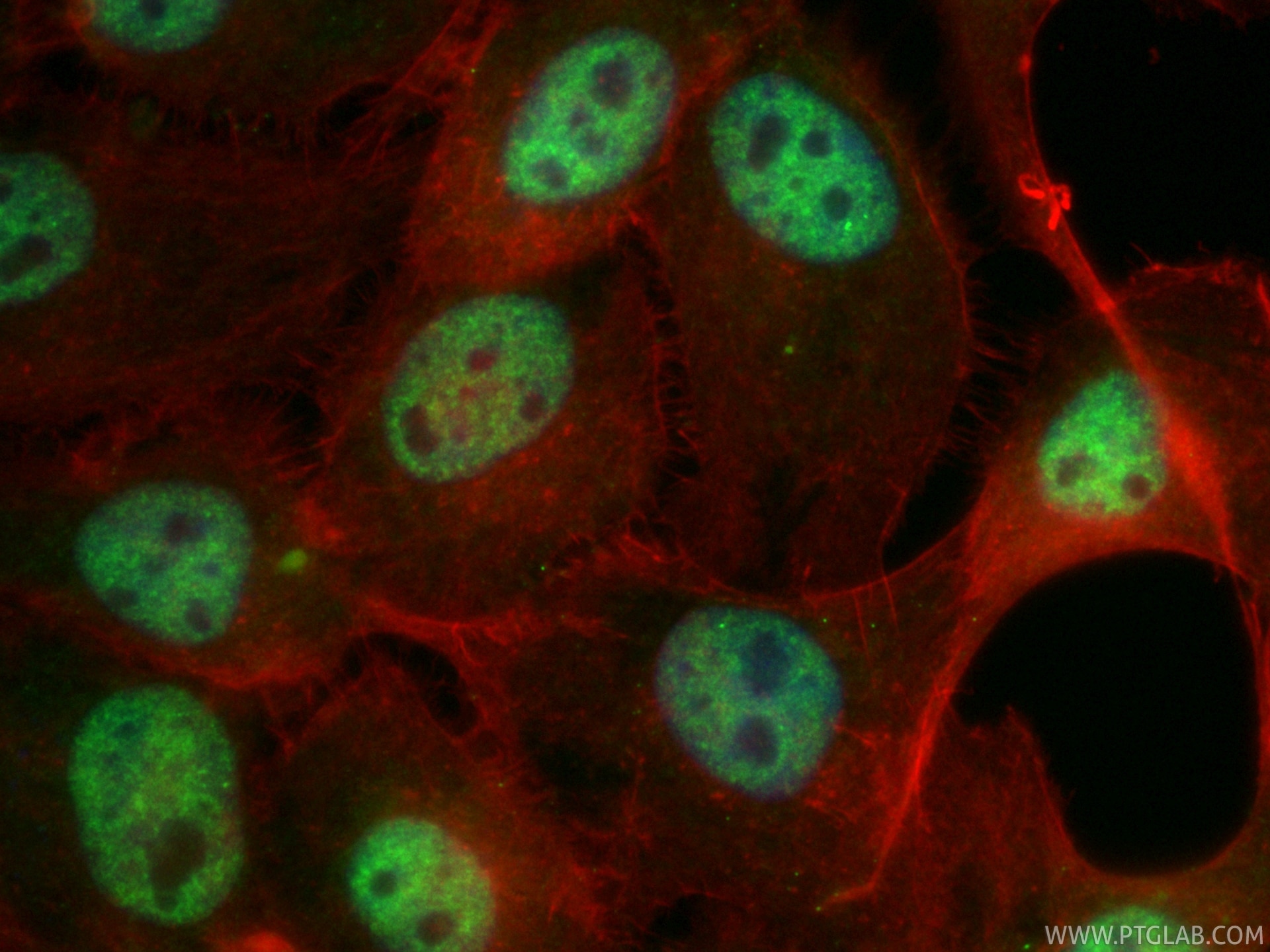 Immunofluorescent analysis of (4% PFA) fixed A431 cells using CoraLite® Plus 488 RBM10 antibody (CL488-84104-2, Clone: 241151D7 ) at dilution of 1:200, CL594-phalloidin (red). Immunofluorescence (IF) / fluorescent staining of A431 cells using CoraLite® Plus 488-conjugated RBM10 Recombinant mo (CL488-84104-2)
