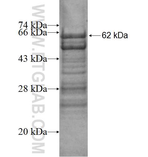 RBM10 fusion protein Ag5788 SDS-PAGE