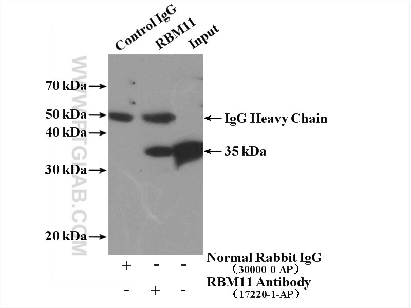 Immunoprecipitation (IP) experiment of HEK-293 cells using RBM11 Polyclonal antibody (17220-1-AP)