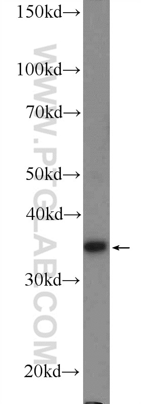 Western Blot (WB) analysis of HEK-293 cells using RBM11 Polyclonal antibody (17220-1-AP)