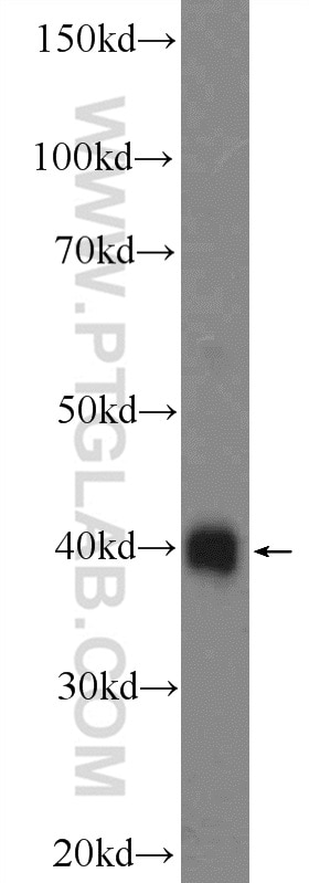 Western Blot (WB) analysis of HEK-293 cells using RBM11 Polyclonal antibody (17220-1-AP)