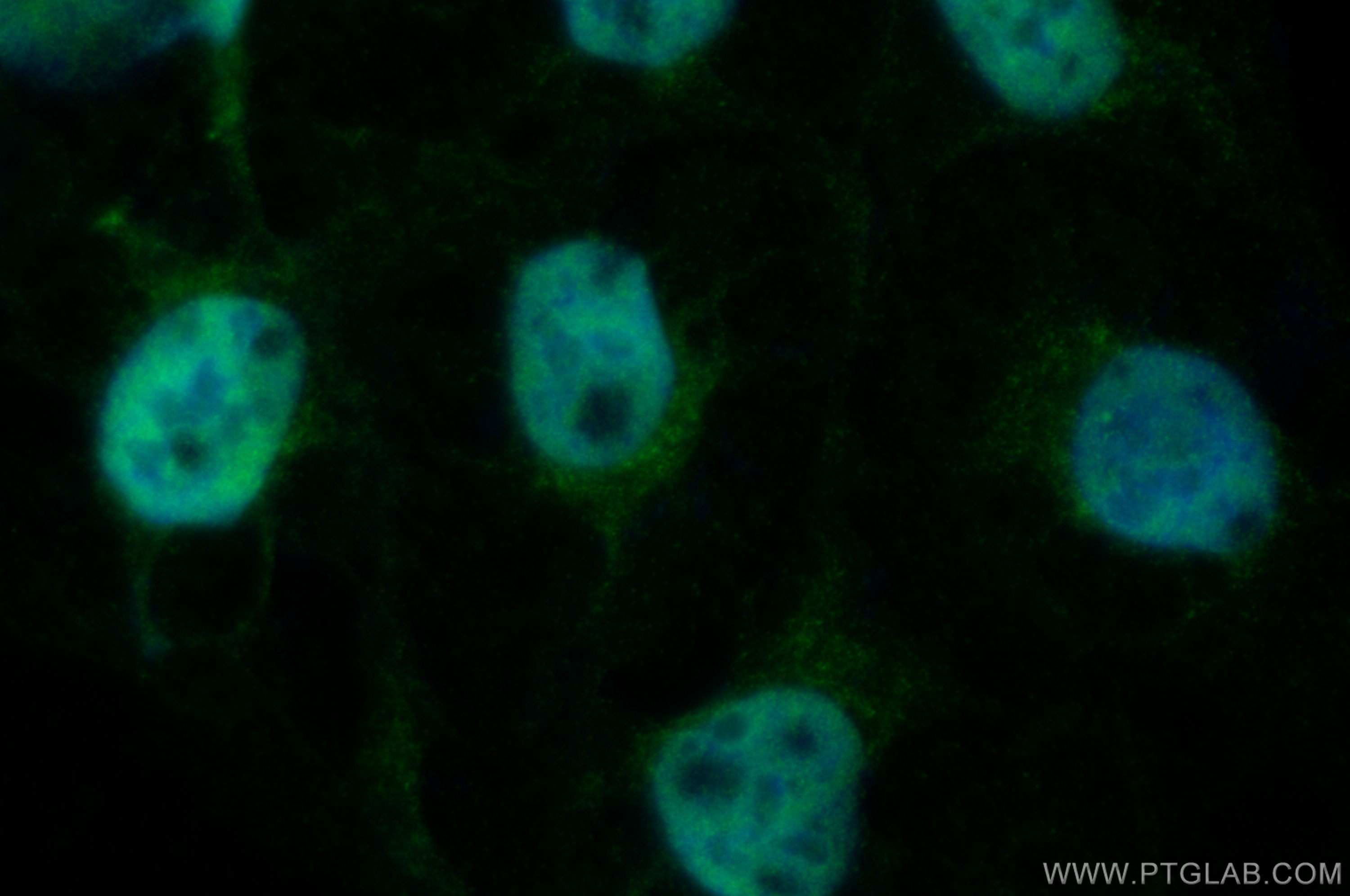 Immunofluorescence (IF) / fluorescent staining of U2OS cells using RBM12 Polyclonal antibody (30990-1-AP)