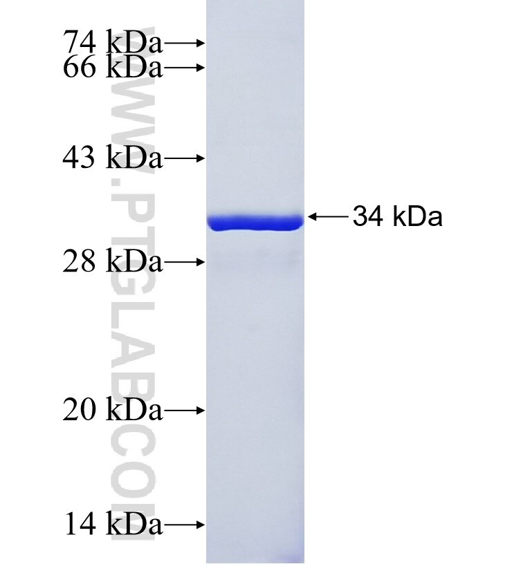 RBM12 fusion protein Ag34621 SDS-PAGE