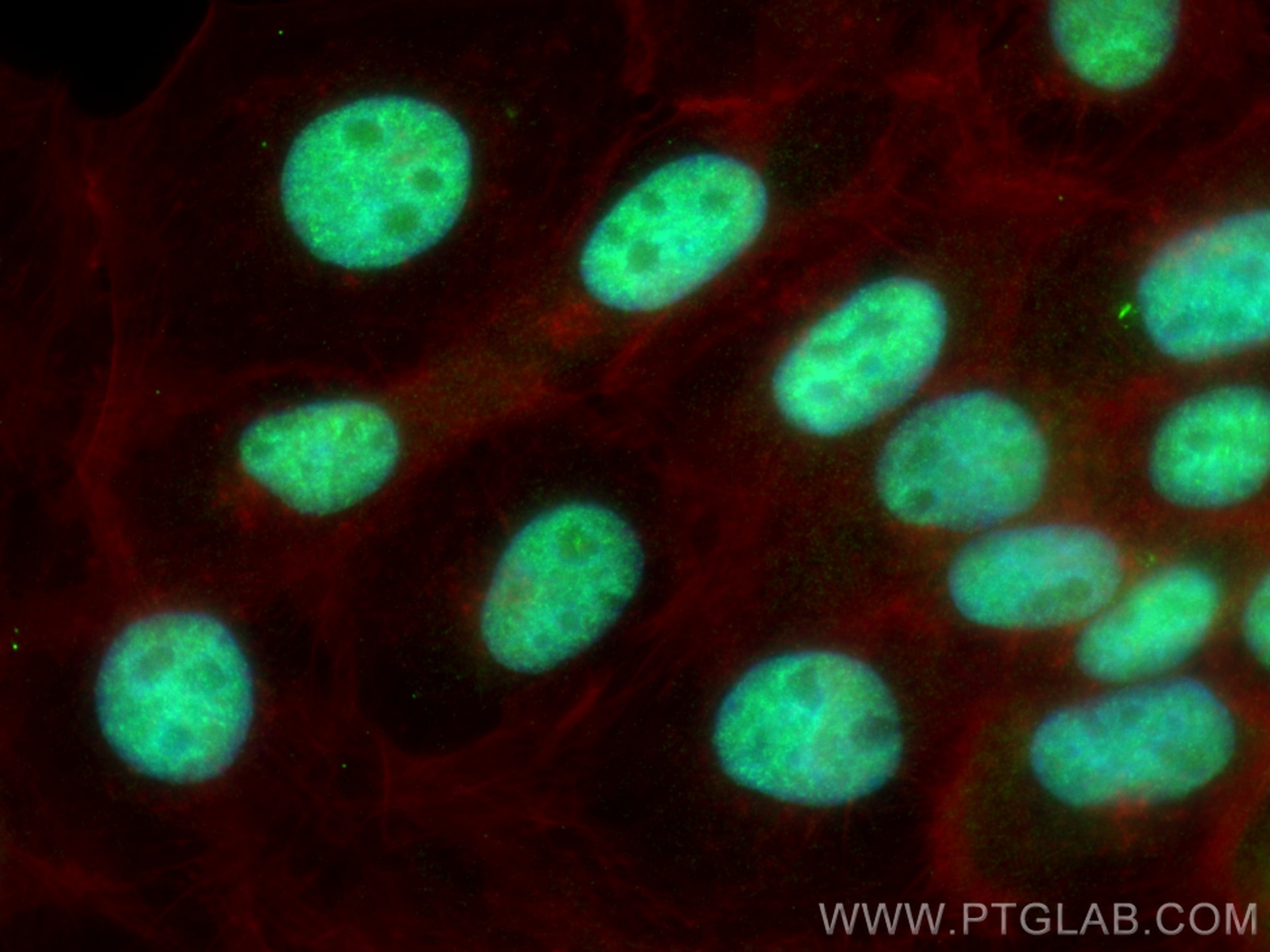 Immunofluorescence (IF) / fluorescent staining of A431 cells using RBM12B Polyclonal antibody (17137-1-AP)
