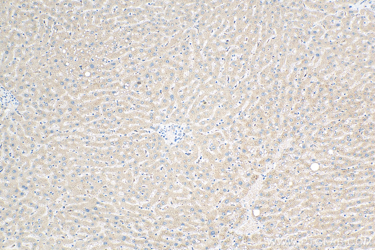 Immunohistochemistry (IHC) staining of human liver tissue using RBM12B Polyclonal antibody (17137-1-AP)