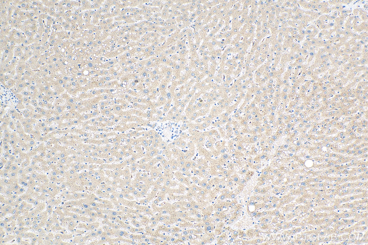 IHC staining of human liver using 17137-1-AP