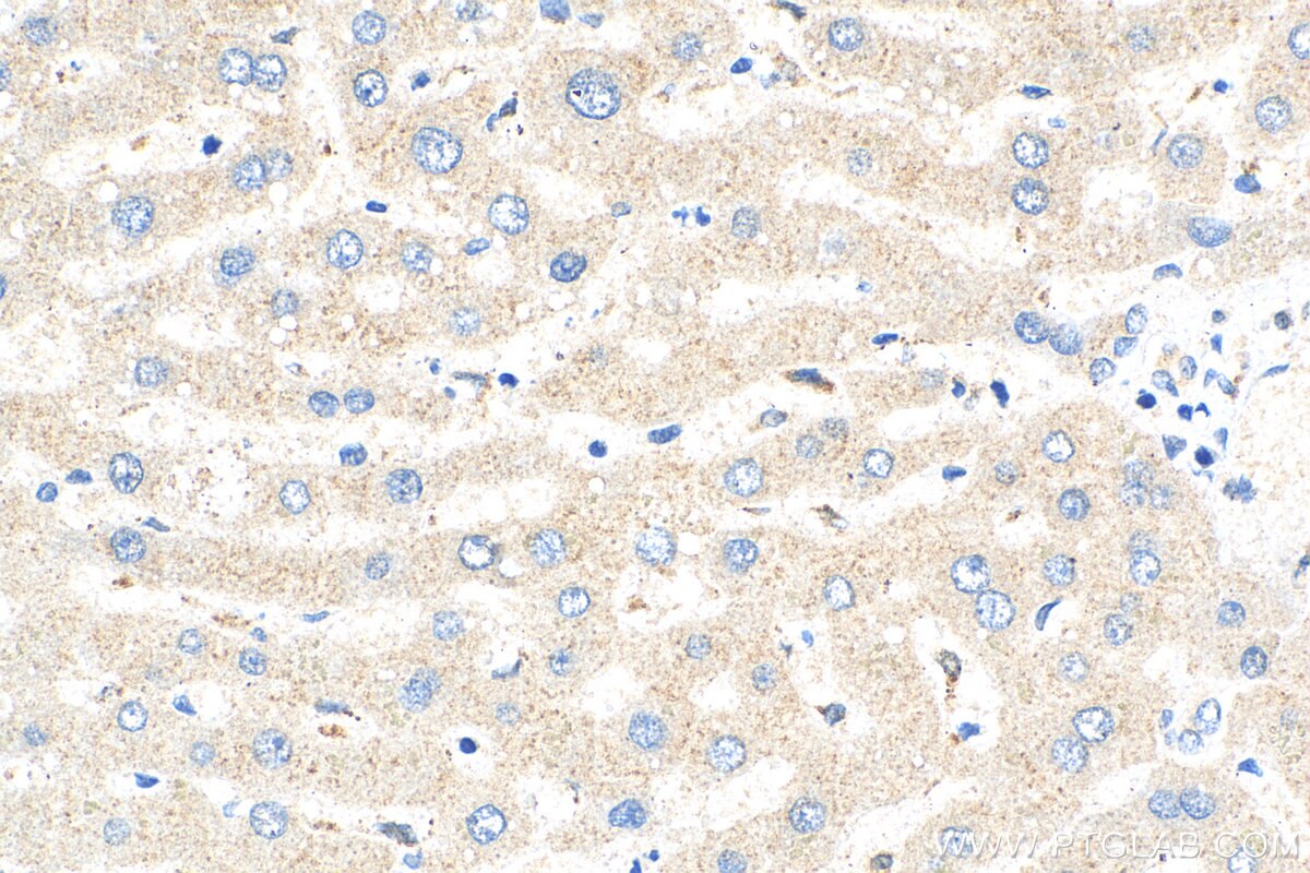 IHC staining of human liver using 17137-1-AP