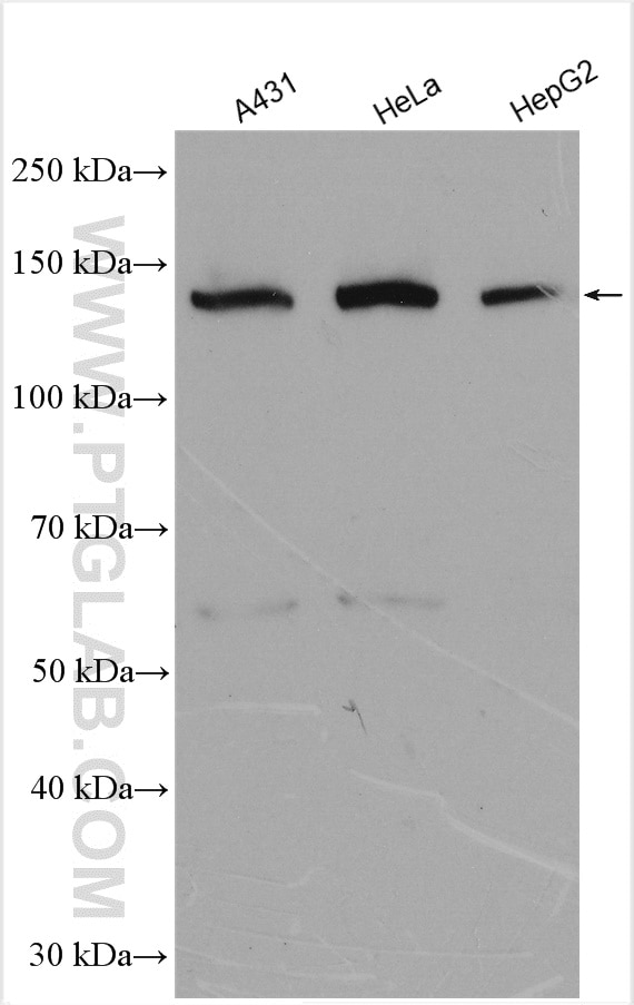 Western Blot (WB) analysis of various lysates using RBM12B Polyclonal antibody (17137-1-AP)