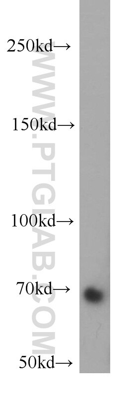 Western Blot (WB) analysis of HeLa cells using RBM14 Polyclonal antibody (10196-1-AP)