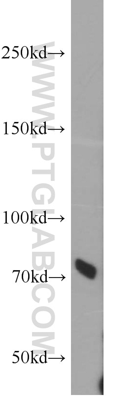 Western Blot (WB) analysis of Jurkat cells using RBM14 Polyclonal antibody (10196-1-AP)