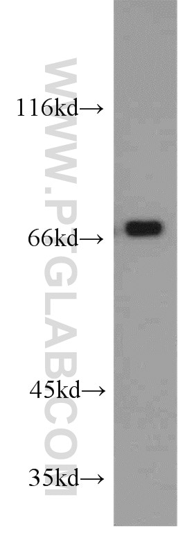 Western Blot (WB) analysis of Jurkat cells using RBM14 Polyclonal antibody (10196-1-AP)