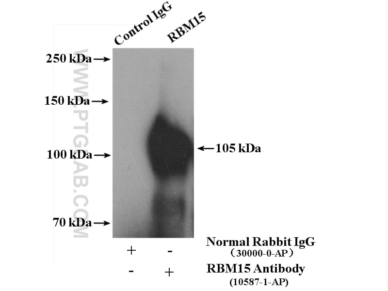 Immunoprecipitation (IP) experiment of HEK-293 cells using RBM15 Polyclonal antibody (10587-1-AP)