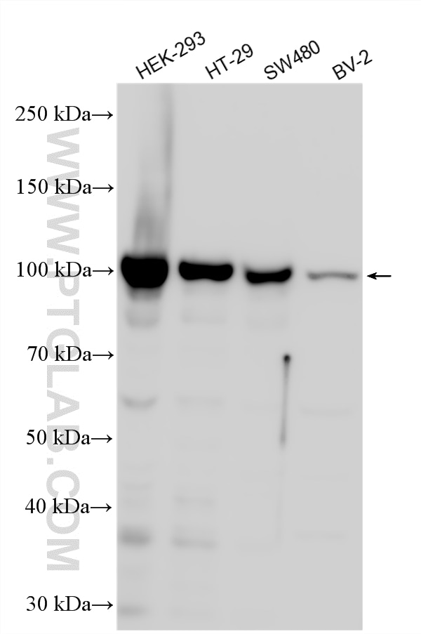 Various lysates were subjected to SDS PAGE followed by western blot with 10587-1-AP (RBM15 antibody) at dilution of 1:10000 incubated at room temperature for 1.5 hours. Western Blot (WB) analysis of various lysates using RBM15 Polyclonal antibody (10587-1-AP)