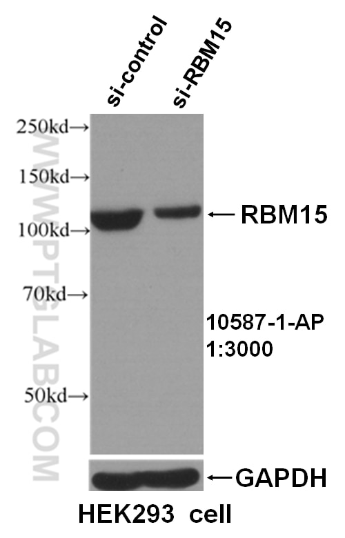 Western Blot (WB) analysis of HEK293 cells using RBM15 Polyclonal antibody (10587-1-AP)