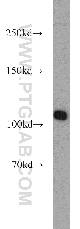 Western Blot (WB) analysis of HEK-293 cells using RBM15 Polyclonal antibody (10587-1-AP)