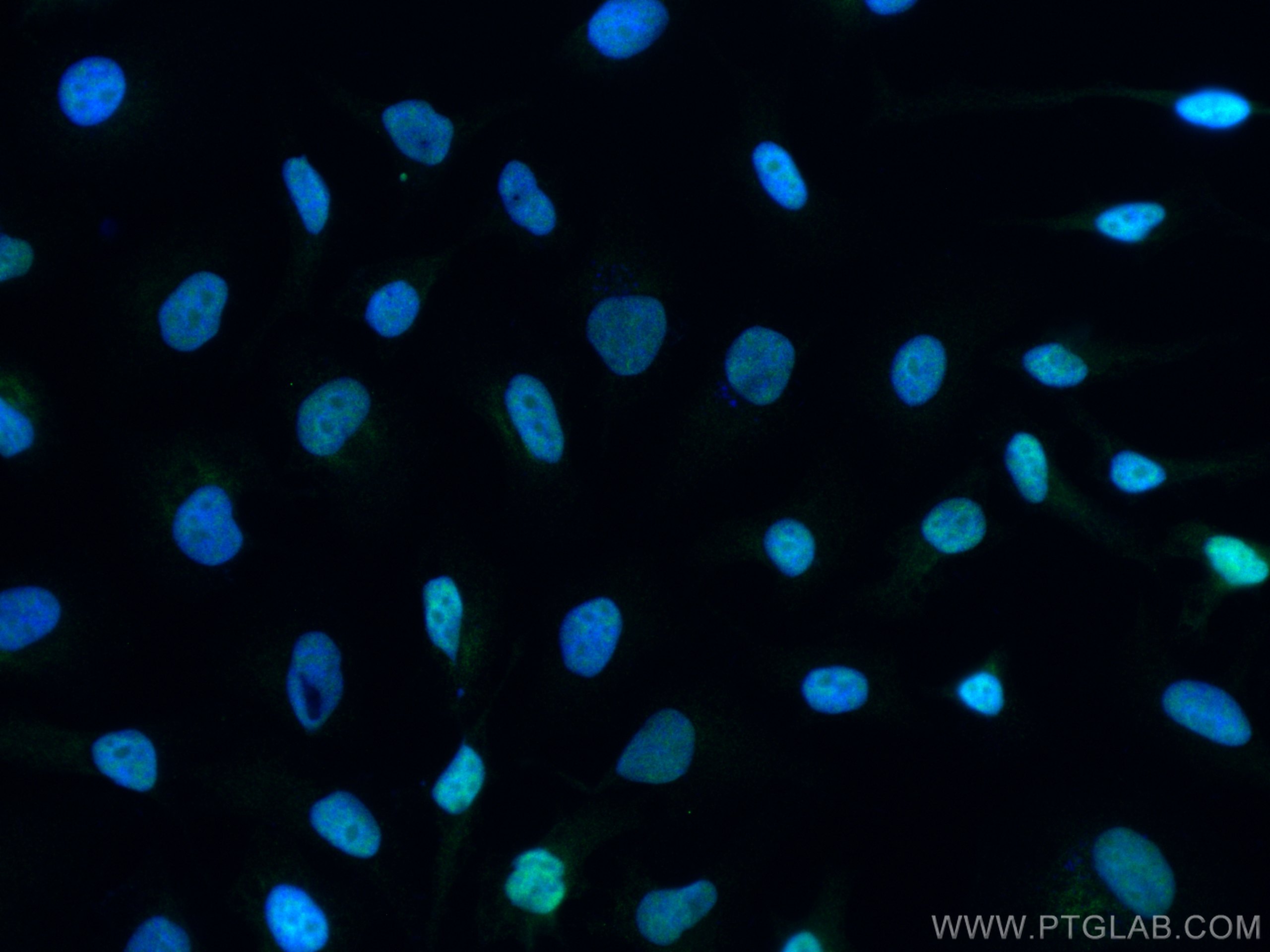 Immunofluorescence (IF) / fluorescent staining of HeLa cells using RBM15 Monoclonal antibody (66059-1-Ig)