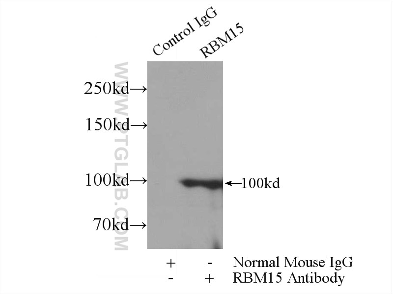 Immunoprecipitation (IP) experiment of HEK-293 cells using RBM15 Monoclonal antibody (66059-1-Ig)