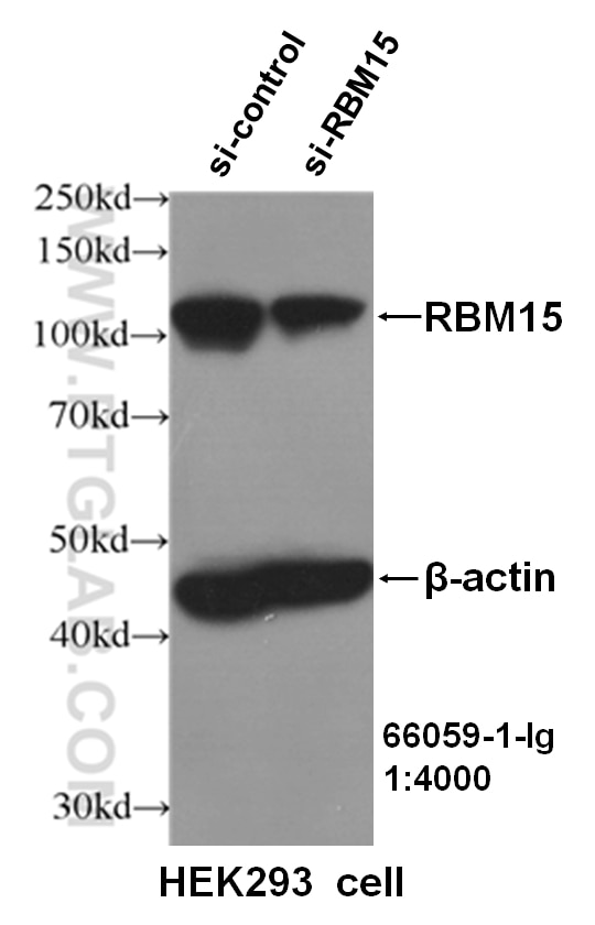 Western Blot (WB) analysis of HEK293 cells using RBM15 Monoclonal antibody (66059-1-Ig)