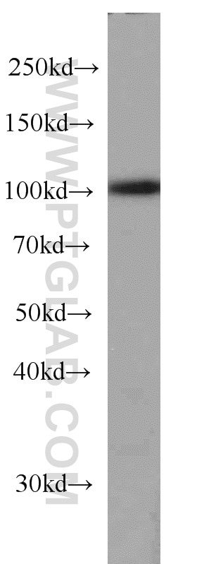 Western Blot (WB) analysis of human brain tissue using RBM15 Monoclonal antibody (66059-1-Ig)