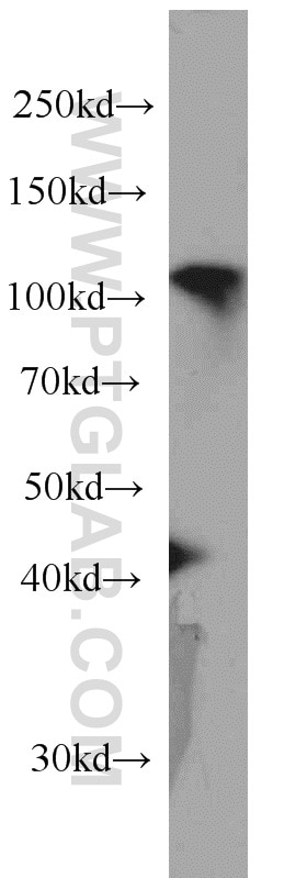 Western Blot (WB) analysis of HeLa cells using RBM15 Monoclonal antibody (66059-1-Ig)