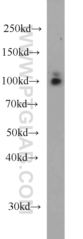 Western Blot (WB) analysis of human heart tissue using RBM15 Monoclonal antibody (66059-1-Ig)