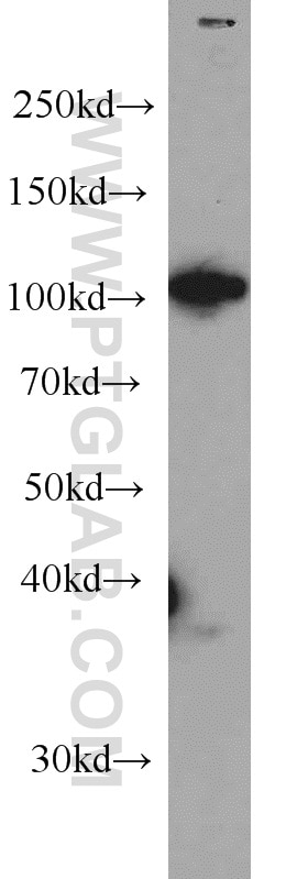 Western Blot (WB) analysis of HEK-293 cells using RBM15 Monoclonal antibody (66059-1-Ig)