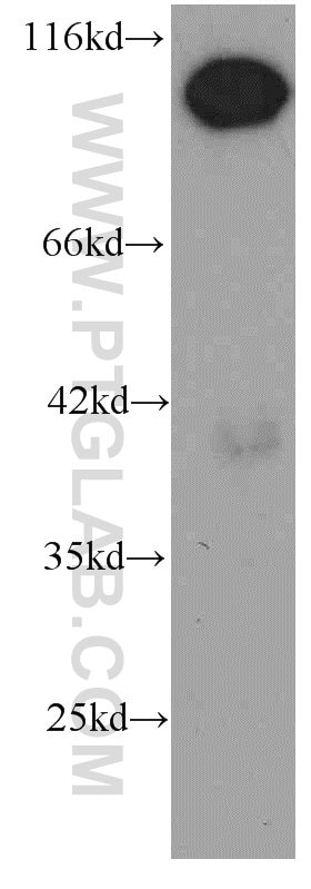 Western Blot (WB) analysis of HeLa cells using RBM15 Monoclonal antibody (66059-1-Ig)