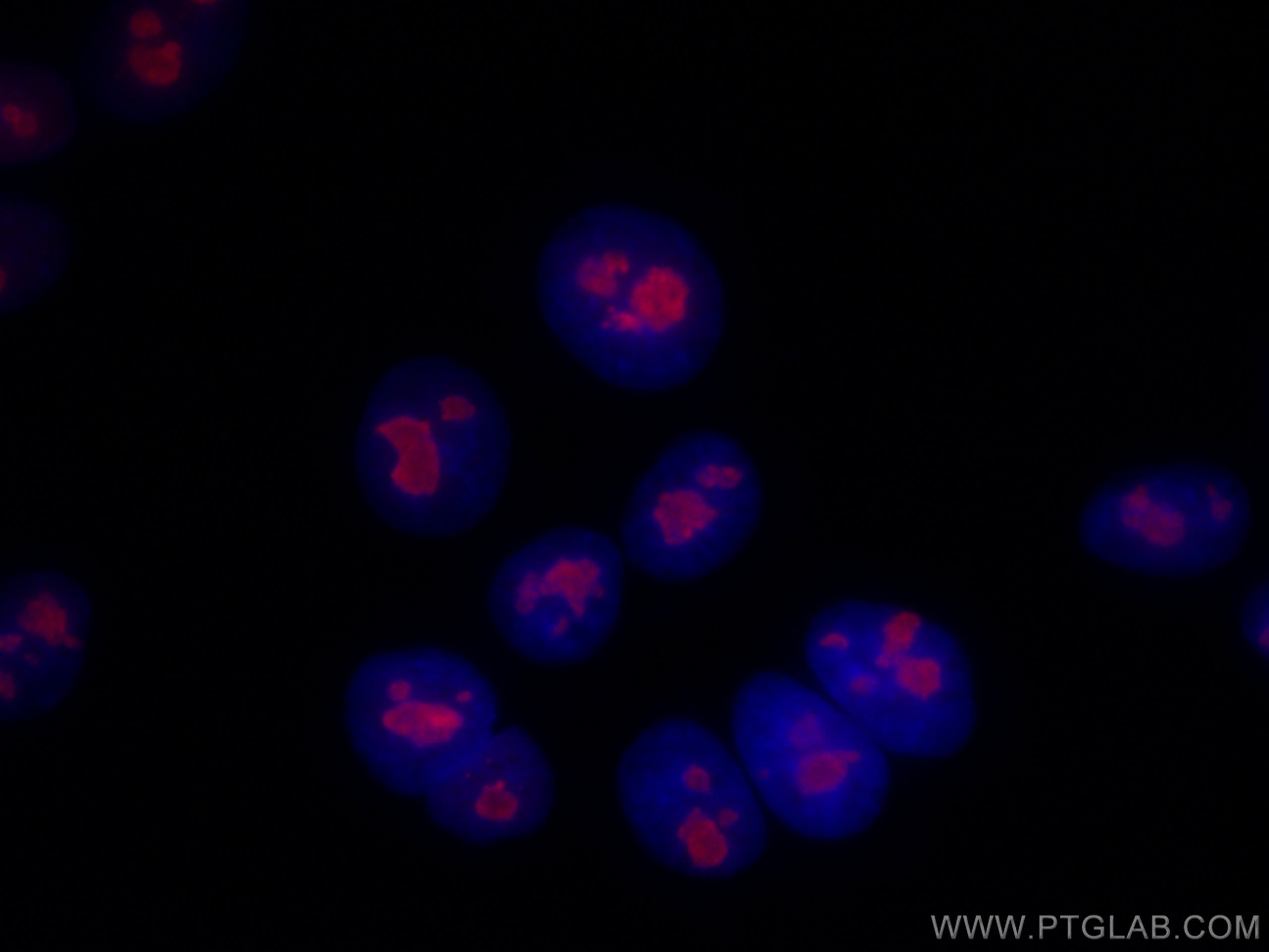 Immunofluorescence (IF) / fluorescent staining of HepG2 cells using CoraLite®594-conjugated RBM15 Polyclonal antibody (CL594-10587)