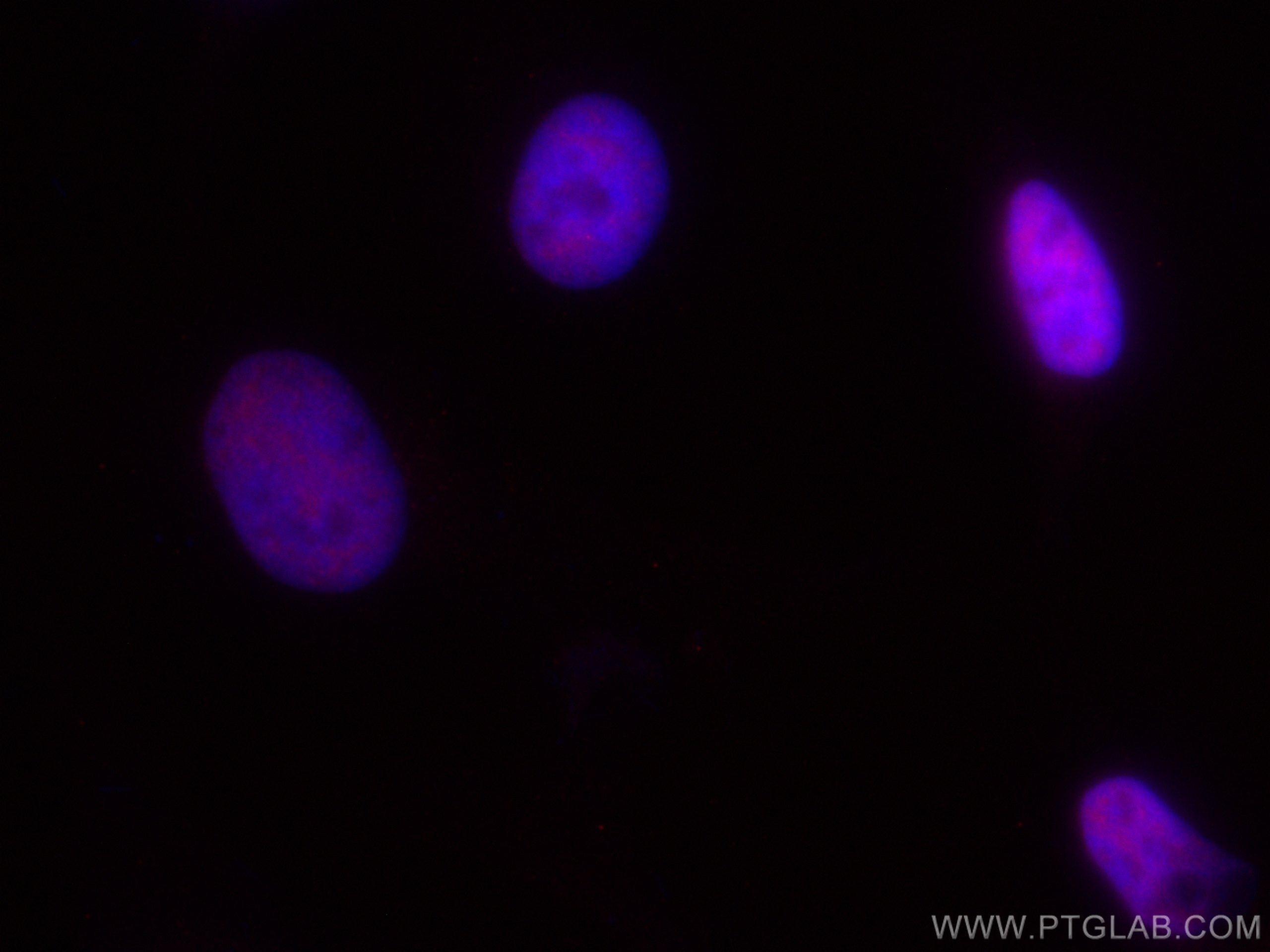 Immunofluorescence (IF) / fluorescent staining of HeLa cells using CoraLite®594-conjugated RBM15 Monoclonal antibody (CL594-66059)