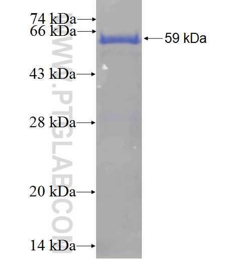 RBM15 fusion protein Ag0938 SDS-PAGE