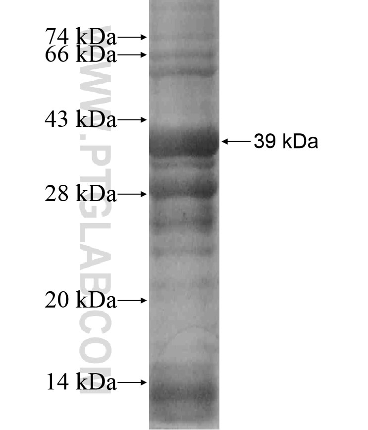 RBM15 fusion protein Ag17970 SDS-PAGE
