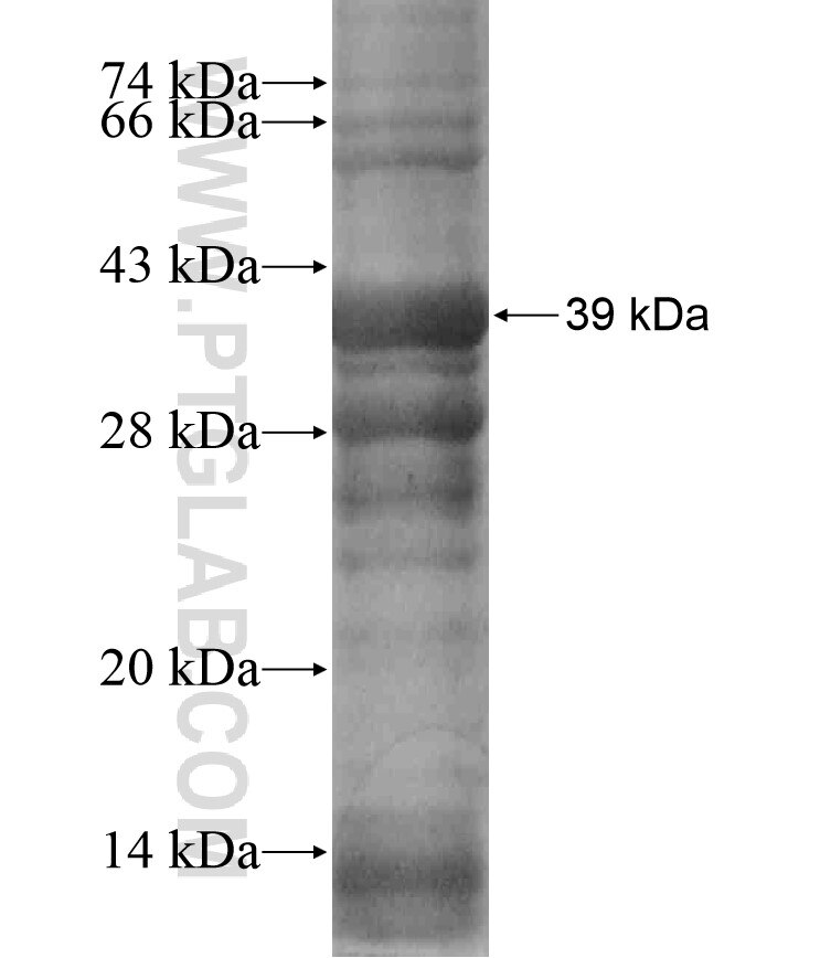 RBM15 fusion protein Ag17970 SDS-PAGE