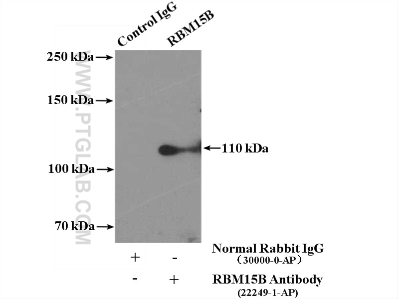 Immunoprecipitation (IP) experiment of HeLa cells using RBM15B Polyclonal antibody (22249-1-AP)