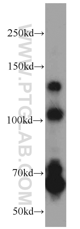 Western Blot (WB) analysis of mouse brain tissue using RBM15B Polyclonal antibody (22249-1-AP)