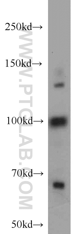 Western Blot (WB) analysis of HeLa cells using RBM15B Polyclonal antibody (22249-1-AP)