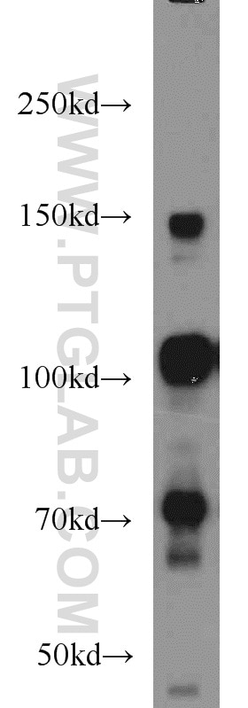 Western Blot (WB) analysis of HEK-293 cells using RBM15B Polyclonal antibody (22249-1-AP)